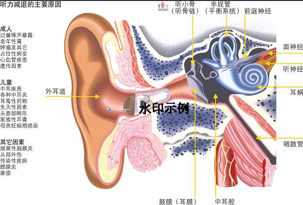听力健康和助听器的重要性